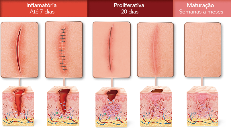 Cicatrização De Cirurgia: Cuidados Essenciais – NVKZ